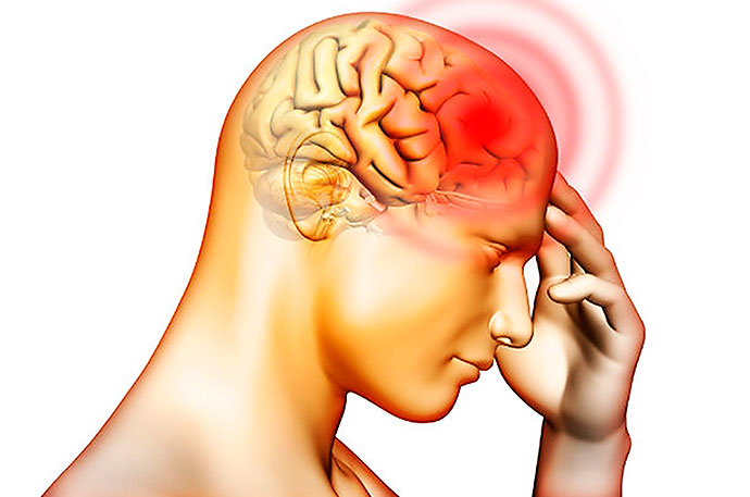 Meningitis: una enfermedad común en invierno pero peligrosa Meningitis: una enfermedad común en invierno pero peligrosa